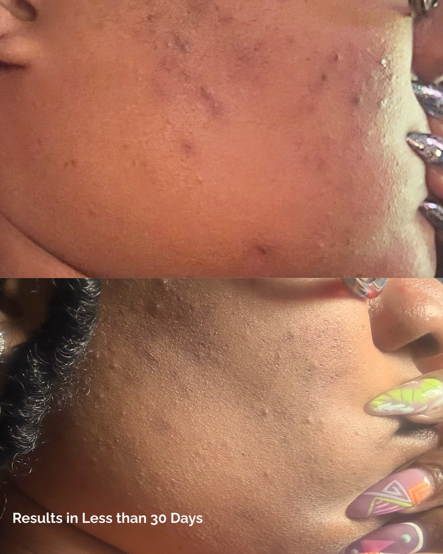 🌟 Clear Complexion Elixir (Dark Spot Fading Gel)