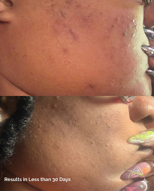 Clear Complexion Elixir (Dark Spot Fading Gel)