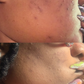 🌟 Clear Complexion Elixir (Dark Spot Fading Gel)