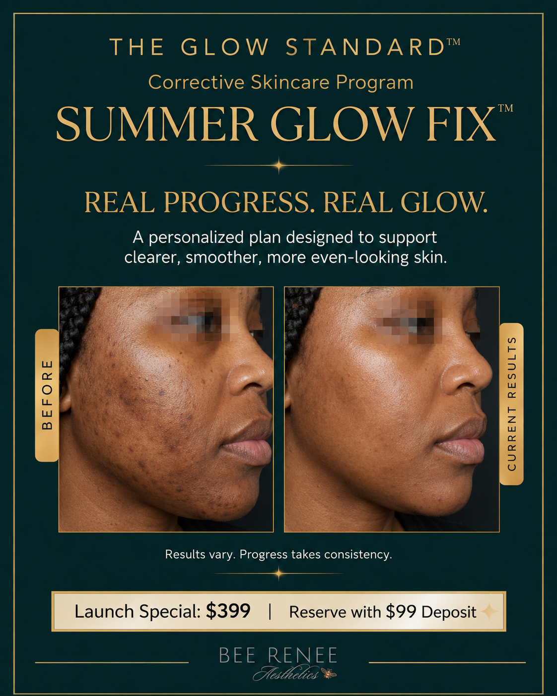 What’s included in the Summer Glow Fix skin reset, featuring two customized corrective treatments, Glow Scan skin analysis, a personalized 30-day skin plan, homecare guidance, and check-in support.